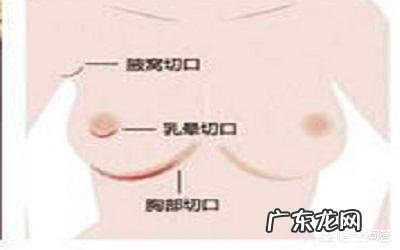 隆胸后，能给宝宝喂奶吗？需要注意什么？