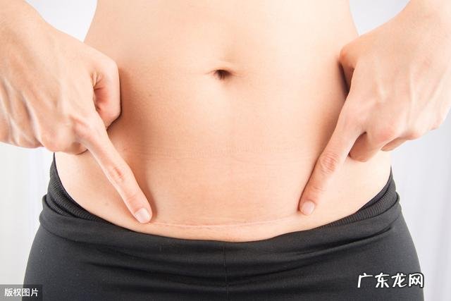 剖腹产对女性有什么影响?产科医生说会留下后遗症不重视会影响终生?