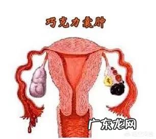 什么是子宫内膜异位症?