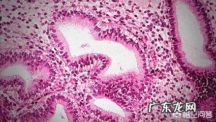 什么是子宫内膜异位症?