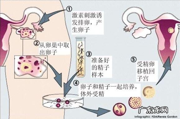 试管婴儿一次成功率有多大？能包成功吗？