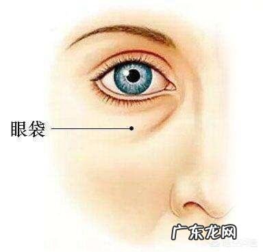 睡醒后眼袋肿了是什么原因呢?