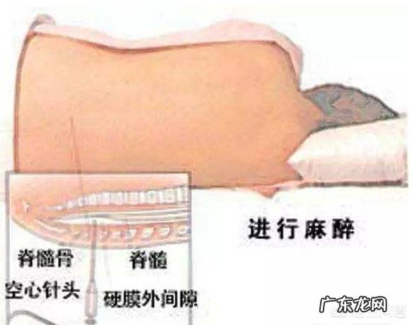 国家卫健委将全国推广无痛分娩,无痛分娩都有什么好处?