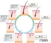 种植头发后多久能长出新的头发？