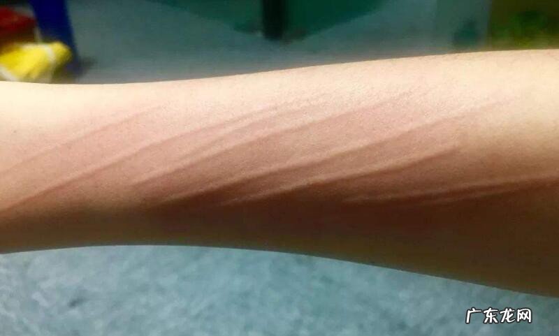 疤痕皮肤怎么修复