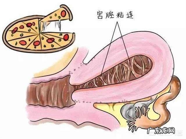 怀孕流产是什么原因呢?为什么会流产呢?