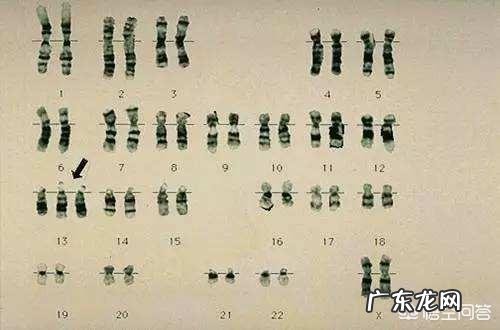 怀孕流产是什么原因呢?为什么会流产呢?