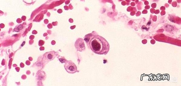 怀孕流产是什么原因呢?为什么会流产呢?