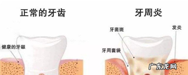 牙齿松了怎么办