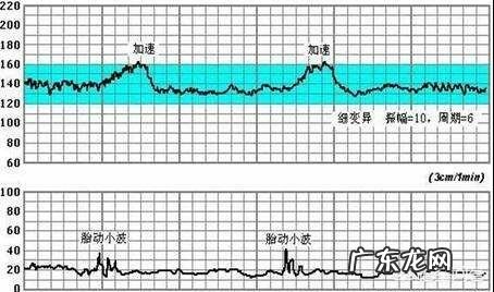 怀孕生男孩,胎心率是每分钟多少下?怀孕时应注意什么?