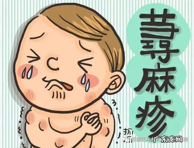 宝宝出荨麻疹了应该怎么办,要不要看医生?