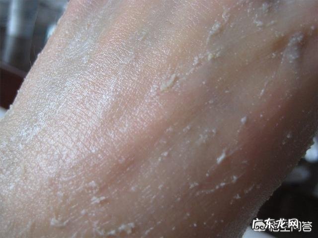 怎么缩小毛孔去黑头?