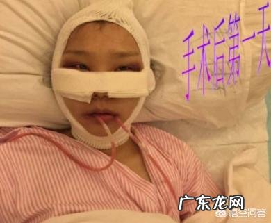 做一个面部下部磨骨整形多少钱,都有什么风险吗?