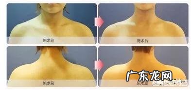 Angelababy美背动人,有哪些有效的背部保养方法?