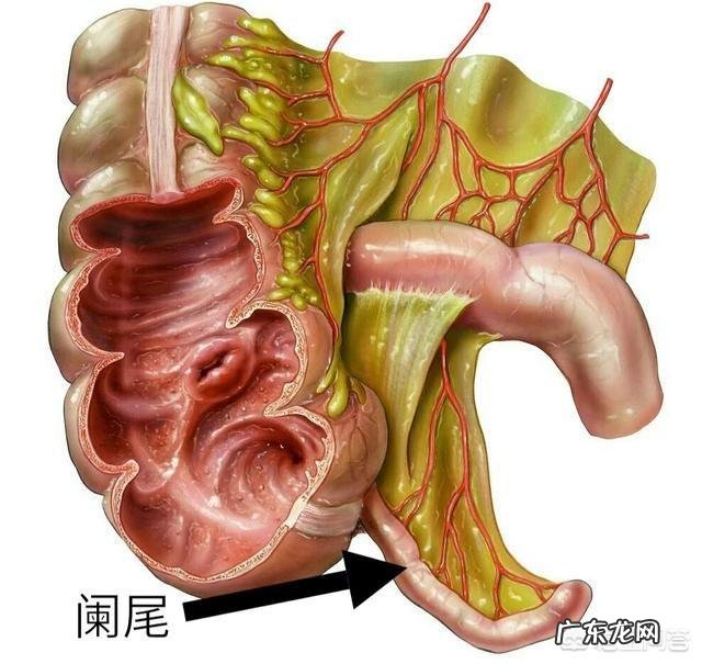 小孩子阑尾炎什么症状?