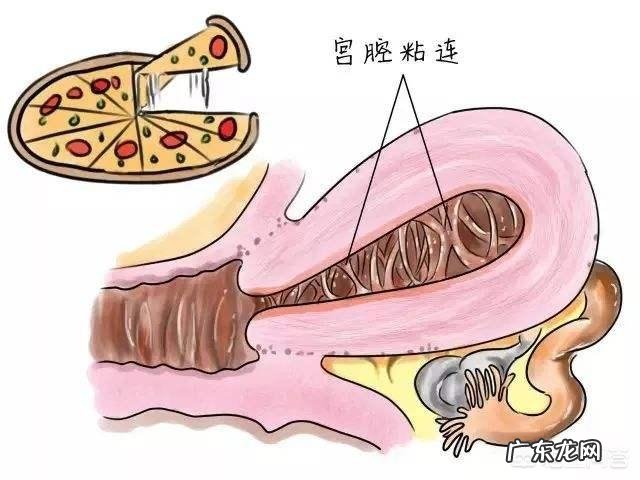 女人多次流产对身体有多大伤害?