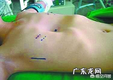 哪些症状是缺少维生素D的信号?