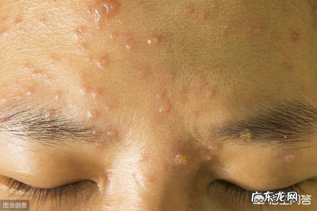 用牛奶敷脸好吗?