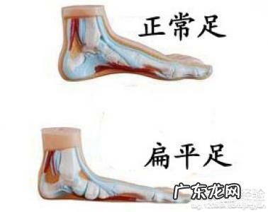 脚心疼痛是怎么回事?