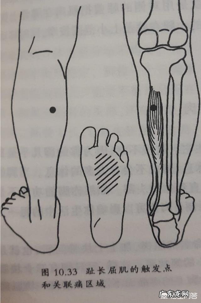 脚心疼痛是怎么回事?