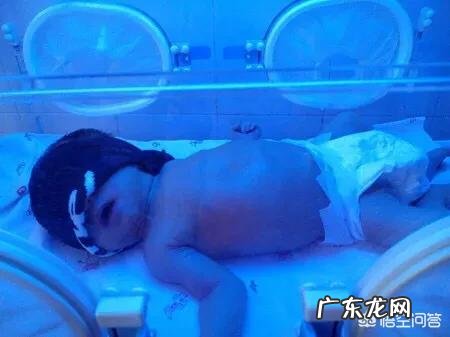 治疗黄疸的蓝光对宝宝有害吗?