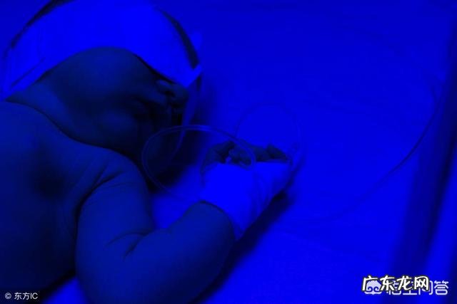 治疗黄疸的蓝光对宝宝有害吗?