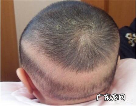 小孩晚上睡觉出汗多怎么办?