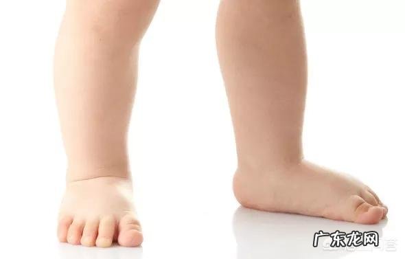 扁平足后天还有矫正的机会吗?