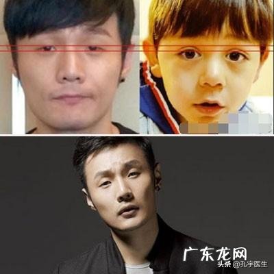 顺便怎么样可以让眼睛变大点,不动手术那种 眼睛太小会有怎么样的烦恼?