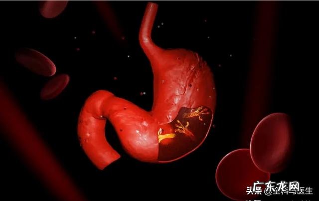 慢性胃炎有哪些症状表现,怎么缓解?