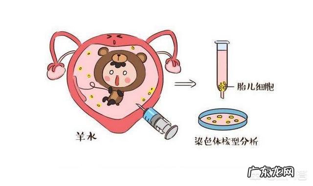 什么时候做唐筛好,是不是每个妈妈都要做?