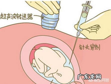 抽羊水检查可以检查什么,现在孕30周了,还可以抽羊水检查吗?