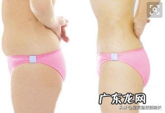 吸脂瘦腰效果到底怎样呢?