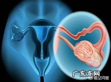 宫颈癌早期有什么症状?