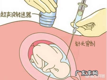 如何评价华大基因无创DNA检查正常但产妇孩子出生伴重要染色体缺陷?