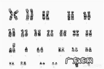 如何评价华大基因无创DNA检查正常但产妇孩子出生伴重要染色体缺陷?