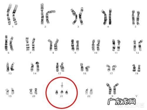 如何评价华大基因无创DNA检查正常但产妇孩子出生伴重要染色体缺陷?