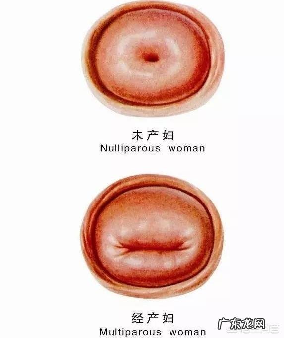 打过胎的女孩怎样看得出来?