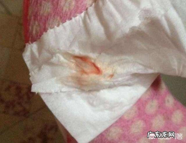 孕晚期见红是什么样的？怎样的是见红呢？