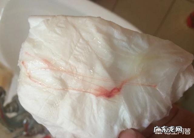 孕晚期见红是什么样的？怎样的是见红呢？