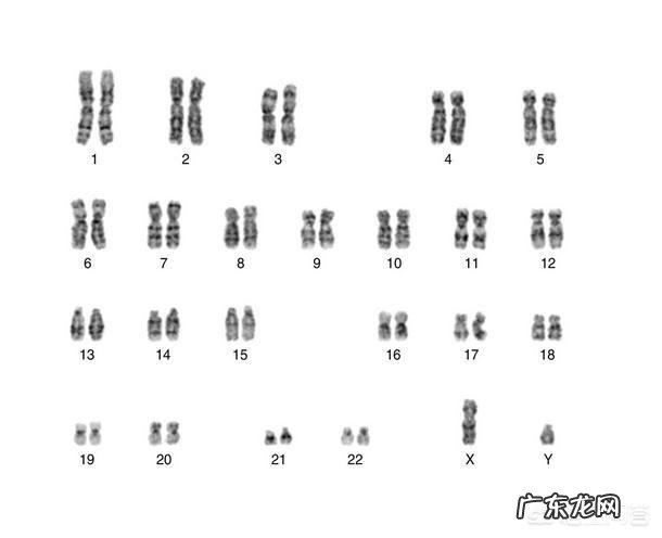 一个人的Y染色体变短,会不会引起性格上的变化?