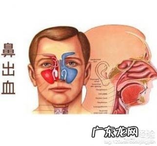 流鼻血是什么原因?