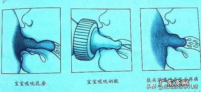 把母乳挤出来用奶瓶喂和直接吸奶有区别吗?