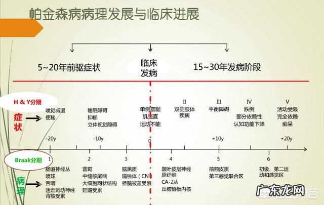 帕金森综合症有哪些症状?