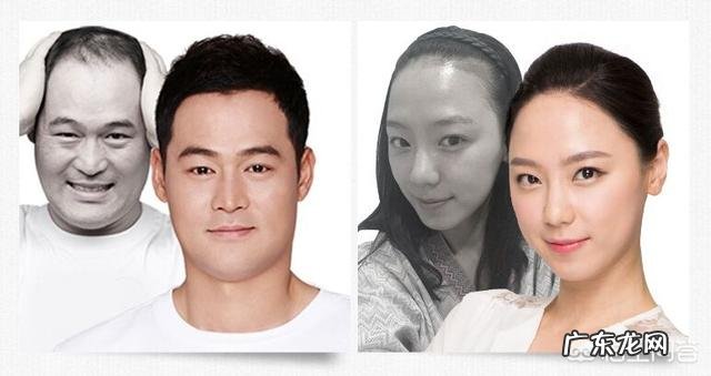 头发稀疏怎么办？