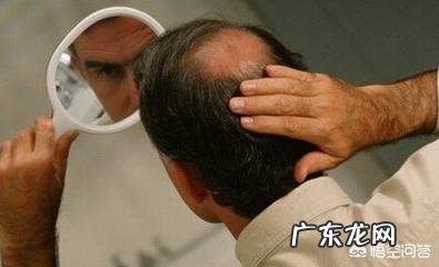 头发稀疏怎么办？