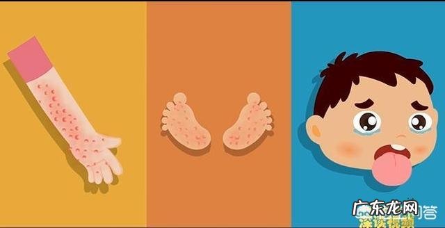 手足口病传染严重吗？