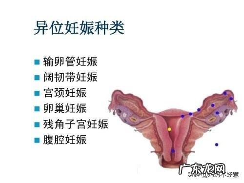 宫颈孕四十天，还能游回子宫里吗？