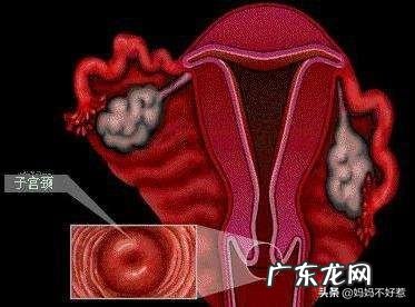 宫颈孕四十天,还能游回子宫里吗?