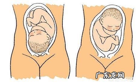 孕检时发现胎位不正怎么办？